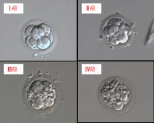 移植囊胚好还是胚胎？试管成功率与囊胚的关系