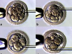 试管婴儿是自己的吗？宝宝是怎么来的？