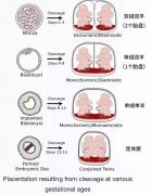 试管双胞胎是单绒还是双绒